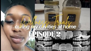 curing cavities at home MAJOR UPDATES The Root Cause documentary oral hygiene tips [upl. by Lomaj]