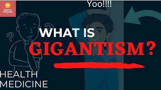 GIGANTISM  CAUSES  TREATMENT  SYMPTOMS  must watch video [upl. by Weintrob]