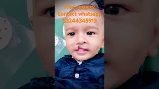 Free surgery cleft lip palate lahore pakistancricket [upl. by Lebana]