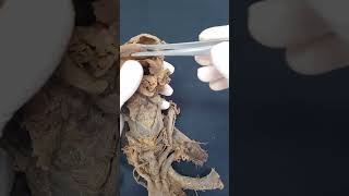 LARINGE PARTE 8  Anatomia humana Shorts medicina anatomia aula anatomy biologia [upl. by Yelekalb]