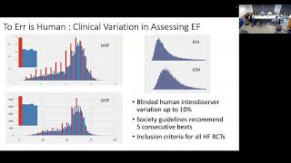 Development to Deployment of Cardiovascular AI [upl. by Llertrac37]