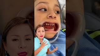 Una niña de 4 años recibiendo tratamiento de conducto y reconstruyendo sus dientecitos 👧🦷 [upl. by Elleron]