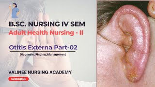 Otitis Externa Part2  Diagnosis Finding Management  Valinee Nursing Academy [upl. by Nyllij]