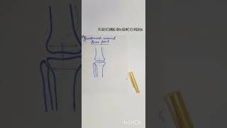 Genicular anastomosis  Anastomosis around Knee joint  YT shorts  Medico Pedia [upl. by Alejna973]