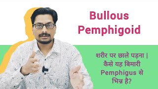 Bullous Pemphigoid  शरीर पर छाले पड़ना  कैसे यह बिमारी Pemphigus से भिन्न है pemphigus blisters [upl. by Ayhtin959]