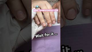 Floral Acrylic nail transformation 🌸 nails transformation beforeandafter acrylicnails newnails [upl. by Reta]