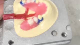 DuraFlex Partials Start to Finish in Only 3 Minutes [upl. by Parrish]