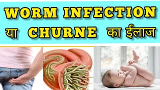 Home Remedies For Worm Infection In Babies In Hindi [upl. by Elbas]