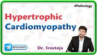 9 Hypertrophic Cardiomyopathy Pathology USMLE Step 1 [upl. by Arbma341]