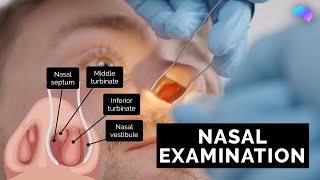 Nasal Examination  Nose Examination  OSCE Guide  UKMLA  CPSA [upl. by Sairu998]