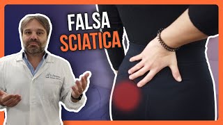 FALSA SCIATICA  Perchè il DOLORE AL GLUTEO non GUARISCE e RITORNA SEMPRE Trattamento OSTEOPATICO [upl. by Mosby645]