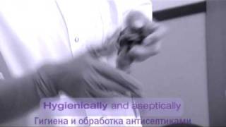 NUTRICIA Flocare NasoGastric TubeНазогастральный зонд Flocare [upl. by Ycat475]