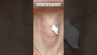 Dark Neck Home Remedies  Neck Whitening TipsGet Rid of Dark Neck skincare ytshorts viral short [upl. by Nadia284]