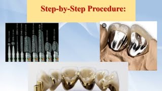 4 Metal Ceramic Crown Preparation StepbyStep PFM بالعربي [upl. by Eicyak567]