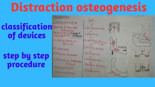 Distraction Osteogenesis partII [upl. by Nairrot892]