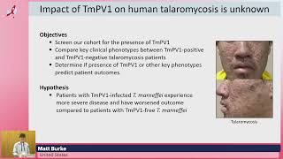 The Role of a Novel TmPV1 Mycovirus on Talaromyces Marneffei Virulence and Its Impact Matt Burke [upl. by Eki]