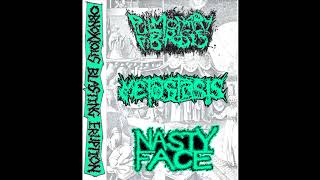 Pulmonary Fibrosis  Metastasis  Nasty Face  Obnoxious Blasting Eruption 3 way split [upl. by Ahtnammas]