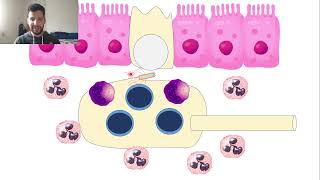 38Salmonelle non typhoide gastroentérite [upl. by Notsag]