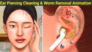 ASMR  Ear Piercing Cleaning  Ear maggot amp worm removal Animation  PV Gaurav [upl. by Highams]