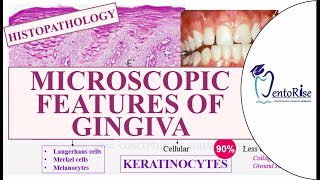 Microscopic features of gingiva  Histopathology of gingiva  Gingiva anatomy Periodontics Carranza [upl. by Carry318]