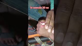 iv cannulation procedure trending  short video doctorsadvice13 [upl. by Akkire]