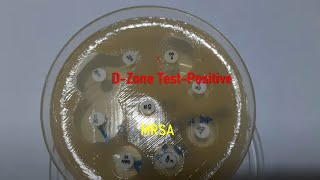 MRSA colony morphology on blood agar and D Zone test Positive strain Demonstration [upl. by Rubia]