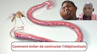 Comment éviter de contracter léléphantiasis [upl. by Heigl]