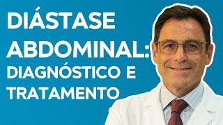 DIÁSTASE ABDOMINAL Sintomas Diagnóstico Causas e Tratamentos [upl. by Durware]