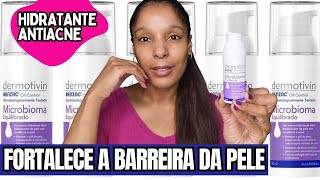 RESENHA GEL CREME HIDRATANTE DERMOTIVIM BENZAC OIL CONTROL MICROBIOMA EQUILIBRADO ACNE PROBIÓTICOS [upl. by Belle463]