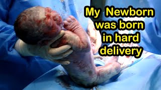 Angry newborn baby was born by a difficult delivery viralbaby newborn [upl. by Artemas]