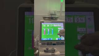 How to change sodium in nikkiso machine nikkiso dialysis [upl. by Naek]