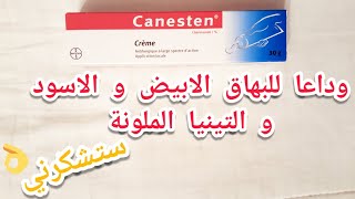 كيفية علاج البهاق الأبيض و الأسود و التينيا الملونة  مرهم كانستين canesten 1 [upl. by Glenna]