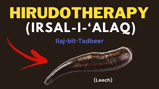 LEECH THERAPY ─ How LEECH Sucks Blood  How to do Leech Therapy at home [upl. by Akli]