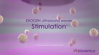 How EXOGEN Works Mechanism of Action [upl. by Hara]