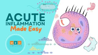 Acute Inflammation Made Easy [upl. by Laumas]