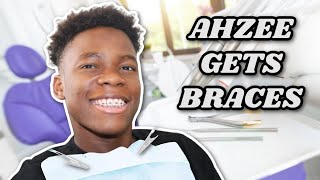 Ahzee finally has braces [upl. by Rooker]