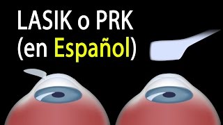 LASIK o PRK Cuál es el adecuado para mí Alila Medical Media Español [upl. by Carthy647]