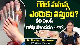 గౌట్ సమస్యకు రిలీఫ్  How to Relieve Gout Pain  High Uric Acid Treatment Telugu  Sankhya Hospital [upl. by Cassilda]