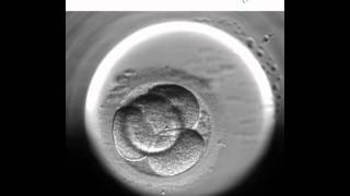 Embryoscope 1  Nuevo método de cultivo y selección embrionaria [upl. by Coray778]