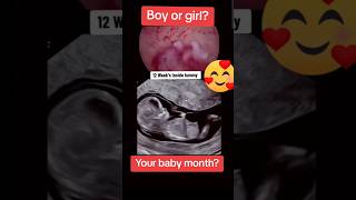 12 weeks baby moving inside mothers womb pregnancy🥰🥰viralvideo trending baby [upl. by Ax]