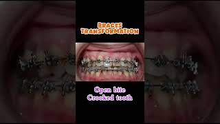 dental dentalclinic trending orthodontist dentist smile dentition yt shorts dentistry [upl. by Syah]