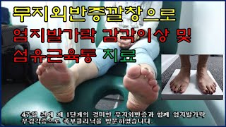 브리즈번 더나은발병원 무지외반증깔창으로 엄지발가락 감각이상 및 섬유근육통 치료 Betta Foot Clinic [upl. by Luhem628]