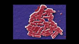 BACTERIA SHIGELLA  PODCAST 3B [upl. by Stirling676]