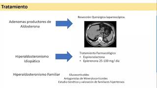 HIPERALDOSTERONISMO HIPOALDOSTERONISMO [upl. by Lecroy314]