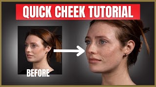 Quick Cheek Filler Tutorial  Cheek Dermal Filler Injection Advice [upl. by Quintana]