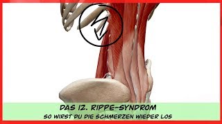 Das 12 RippeSyndrom  SO wirst DU deine SCHMERZEN wieder los  detaillierte BEHANDLUNG [upl. by Ulphi931]