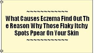 What Causes Eczema  Atopic Dermatitis  Eczema Dermatitis Rash Treatment [upl. by Imehon]