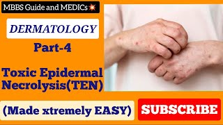 Toxic Epidermal Necrolysis made EASY UrduHindi mbbsguide mbbsguideandmedics [upl. by Aracal]