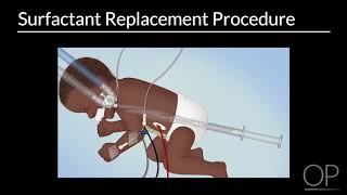 Surfactant Replacement in Neonates by B Walsh  OPENPediatrics [upl. by Fink]