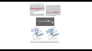 Emergency care chap 3  Airway management part 2 [upl. by Kareem65]